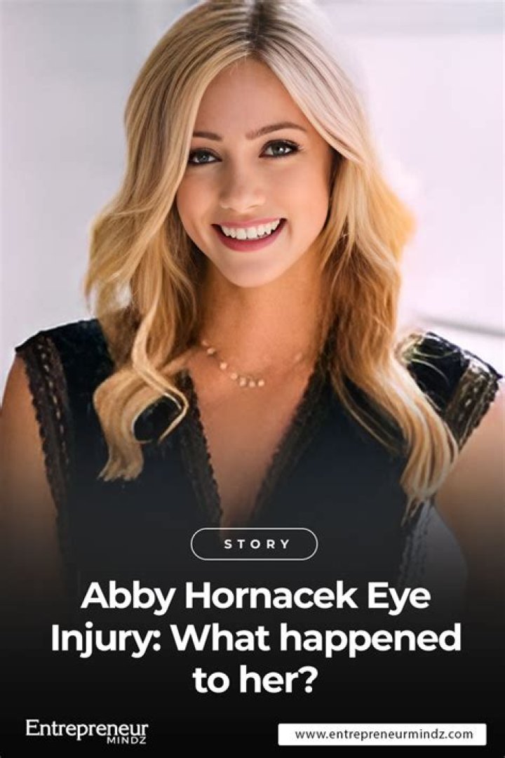 Abby Hornacek's Eye: A Closer Look at Her Unique Feature and Its Impact