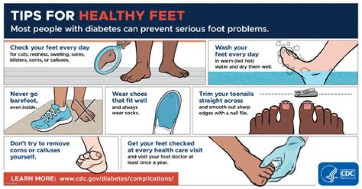 Erica Hubbard Feet: A Comprehensive Guide to Foot Care and Health